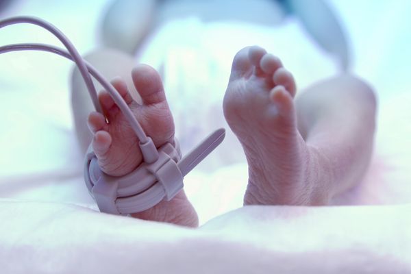Multidisciplinary care of a child with renal agenesis treated at Primary Children's Hospital in Utah