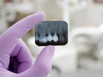 dental xray