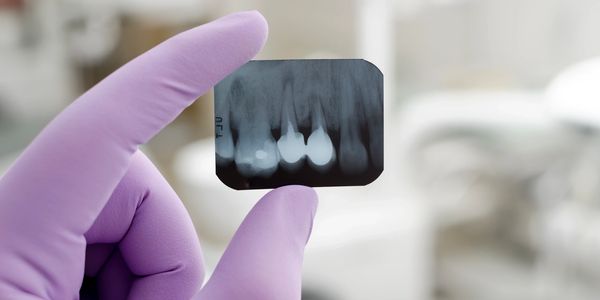Dental x-rays are an essential diagnostic tool to show us the health of teeth and gums. 