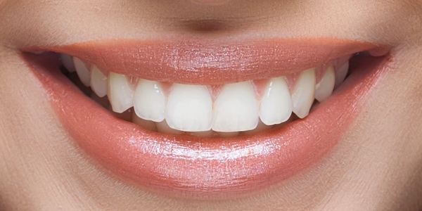 Best Dentist in Guwahati.