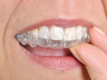 Nightguard: Custom dental device protects teeth from grinding, ensuring restful sleep and dental hea