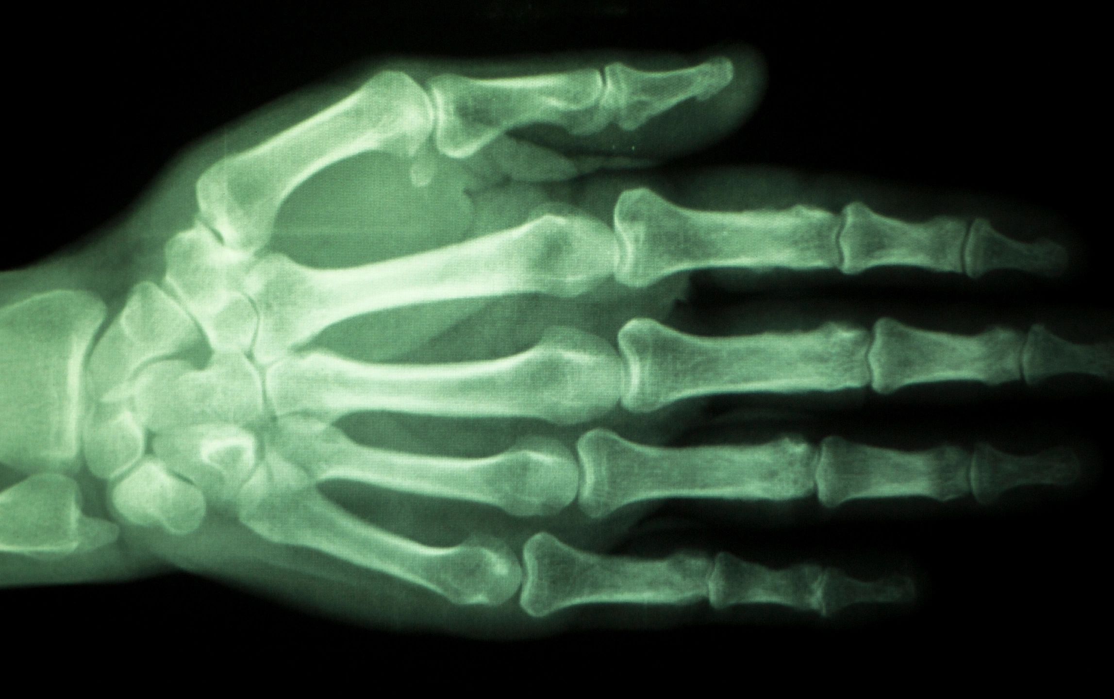 Cypress Hand & Wrist - Hand Doctor, Hand Surgery