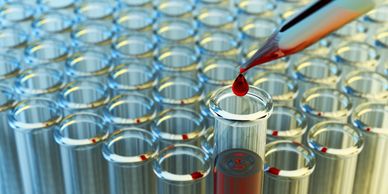 Intracellular, nutrients, micronutrients, deficiency, vitamins, minerals, antioxidants, immunity