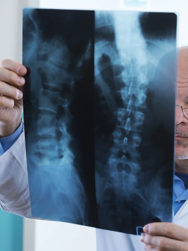 Actor pretending to be a male Chiropractor or Physiotherapist reading a back x-ray