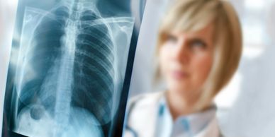 Mesothelioma Asbestos Lung Cancer Lawsuits