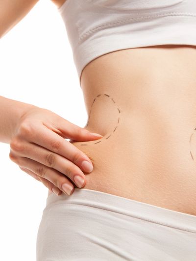 How Much Does CoolSculpting Cost in Canada?