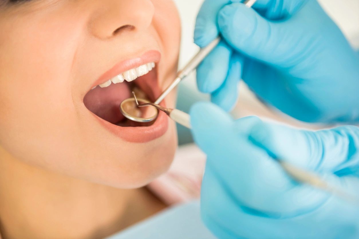 Dental cleaning