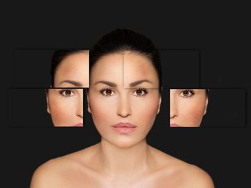 A woman's face with magnified images of her cheeks and forehead