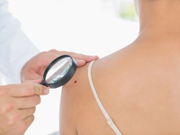 Doctor checking the skin of the patient