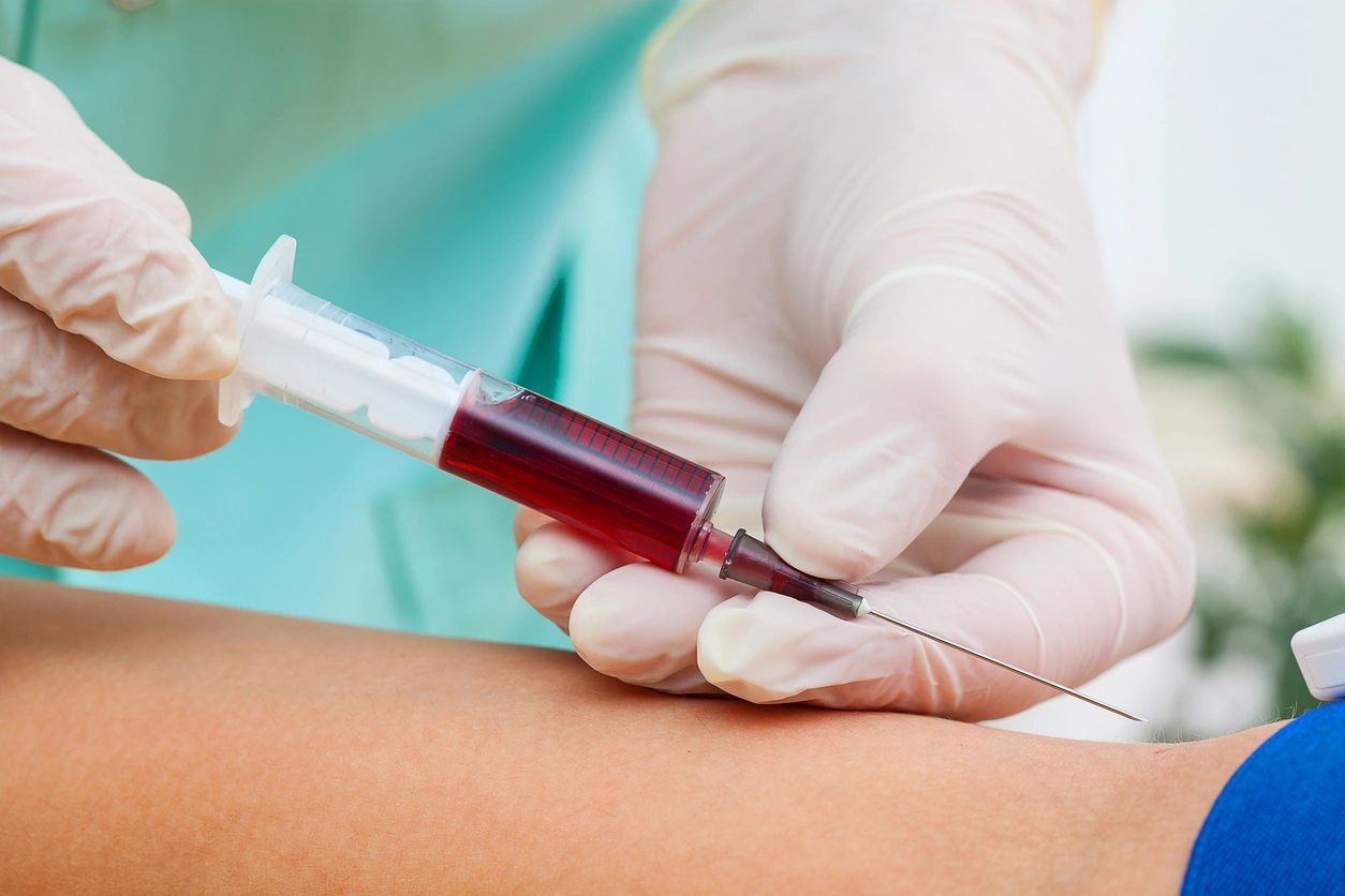 Platelet-Rich Plasma (PRP) Therapy: What to Expect and Aftercare