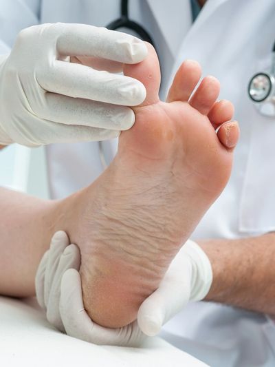 biochemical assessments, foot doctor, feet, foot clinic, check-up, 