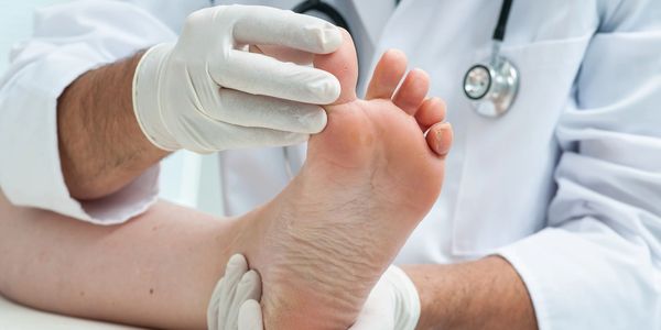 Doctor examining a patient's foot while wearing gloves.