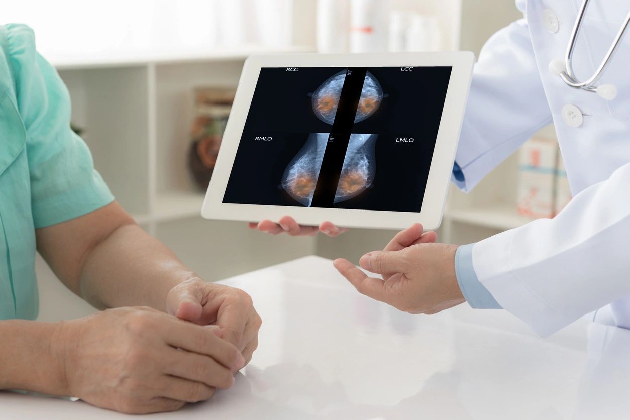 What Is a Mammogram?