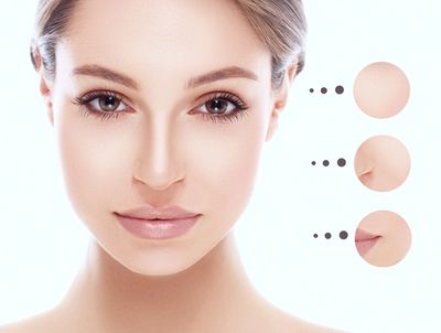 Which Face Peel Is Right for Your Skin? - Spa MDSpa MD