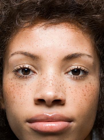Freckles, you can have semi permanent or permanent