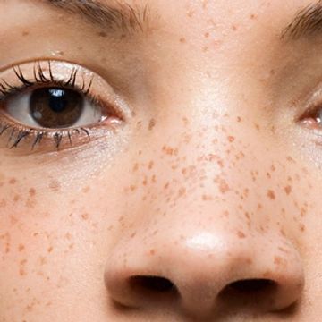 zoomed in image of freckles on face
