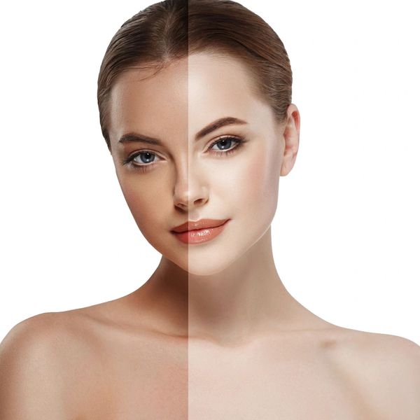 A woman's face showing a before and after skin transformation split vertically.