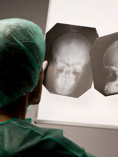 Medical professional examining two skull X-rays against a light panel.