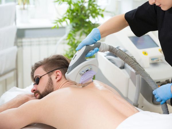 Man receiving laser hair removal treatment on his back.