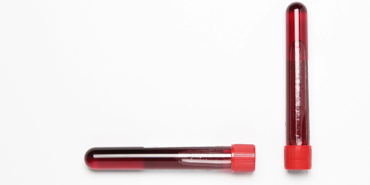 Laboratory Sample Transport Packaging Solutions