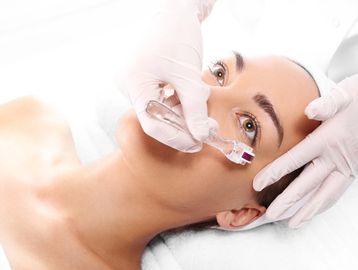 Ageless Spa Lactic Acid Peel - Gentle and Nourishing Skin Renewal in Las Vegas Day Spa