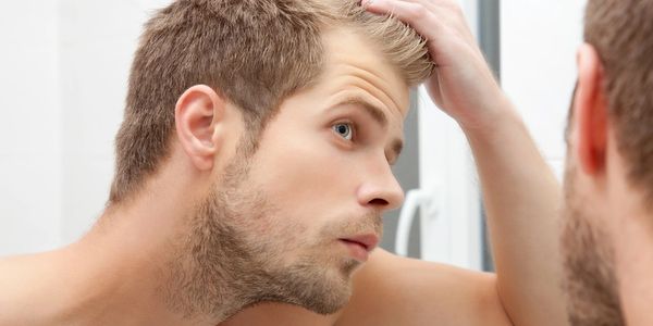 Male pattern baldness and hair loss 