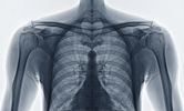 X-ray image showing the ribcage and chest area.