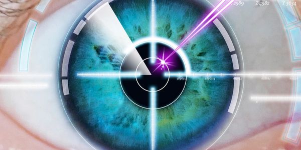 Images of lasers focus on the cornea, the clear surface of the eye