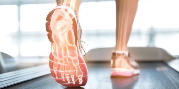 an outline of foot and leg bones is illustrated through the legs and feet on a treadmill