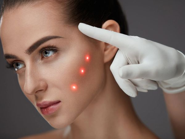 a woman receiving a face treatment