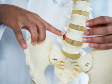 Hands pointing at a lumbar spine model.