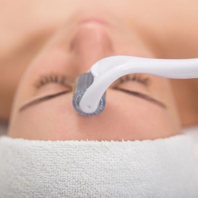 Accredited microneedling training, Accredited dermaroller training, collagen induction training