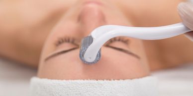 Person receiving microneedling facial treatment with a derma roller.