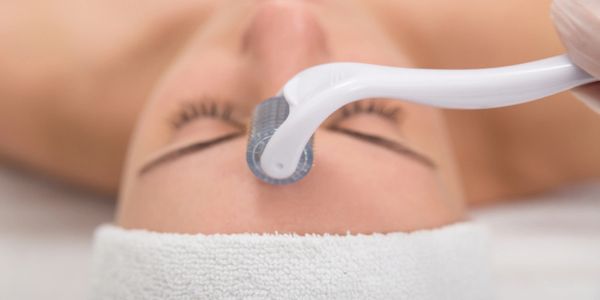 Microneedling