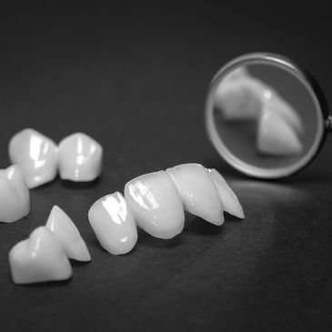 Dental veneers and a dental mirror on a dark surface.