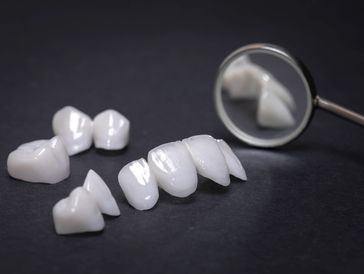Missing tooth solution: Dental bridge restores smile, function seamlessly