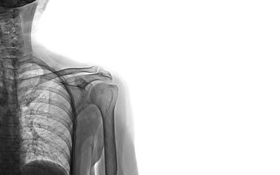 Treatment of shoulder pain 