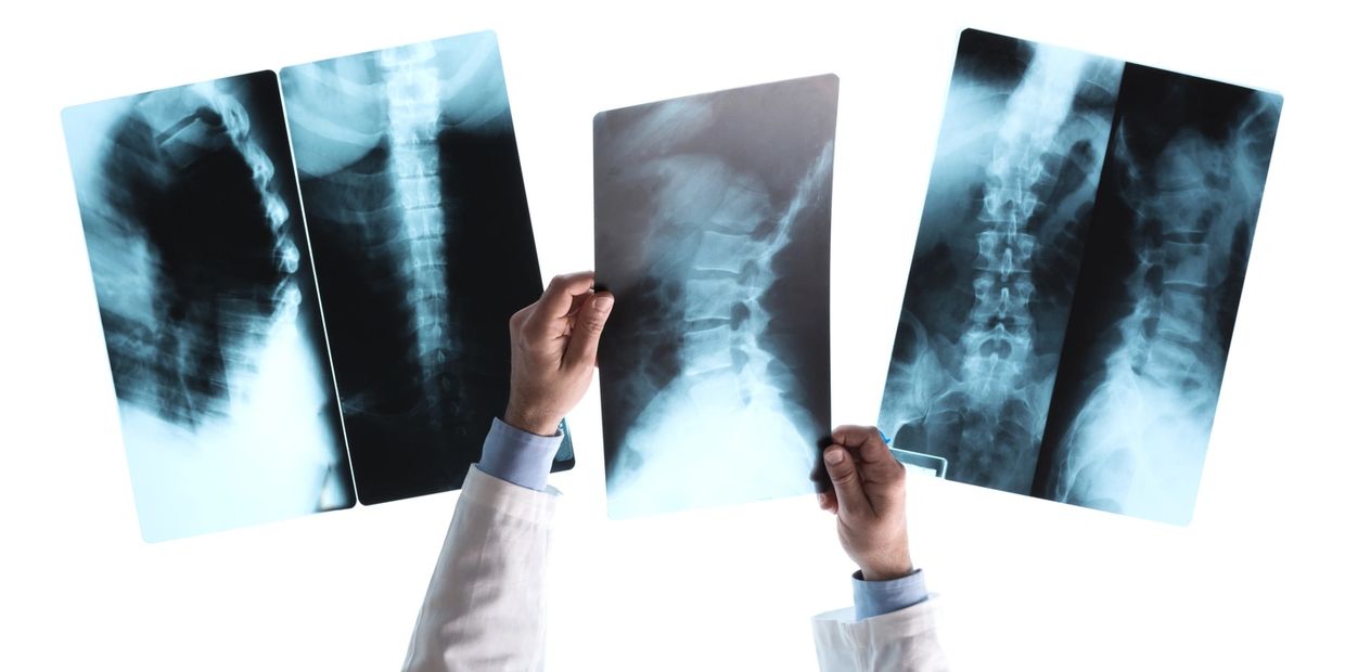 Chiropractic diagnostic imaging and X-ray services at Live Well Chiropractic