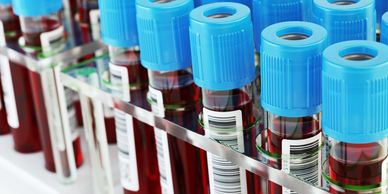 low-cost options for comprehensive blood tests or tests for specific diseases.