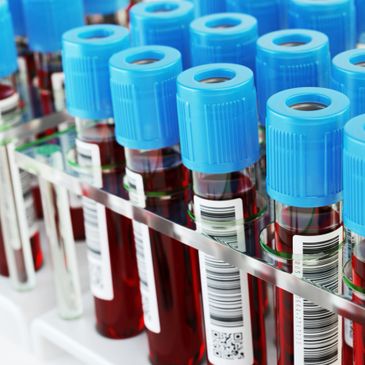 Blood samples in test tubes with blue caps in a lab rack.