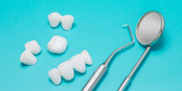 dental implant loose, dental implant crown loose, dental implant moving, dental implant infected. 