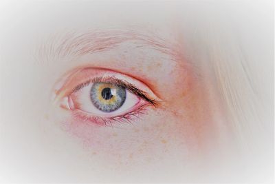 Close-up picture of an eye