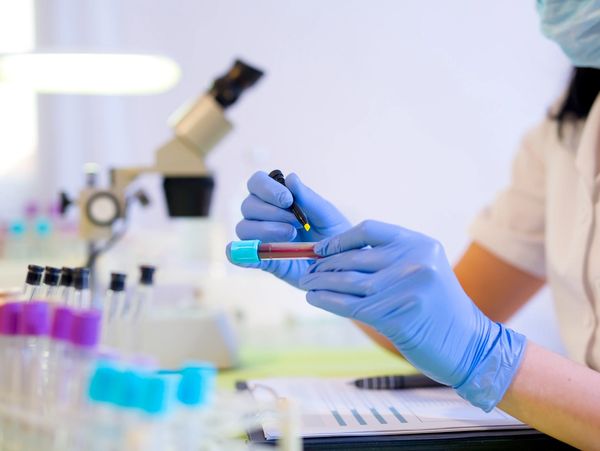 Lab technician handling a blood sample with a pipette in a medical lab.