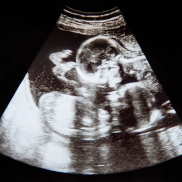 Medical ultrasound baby scan