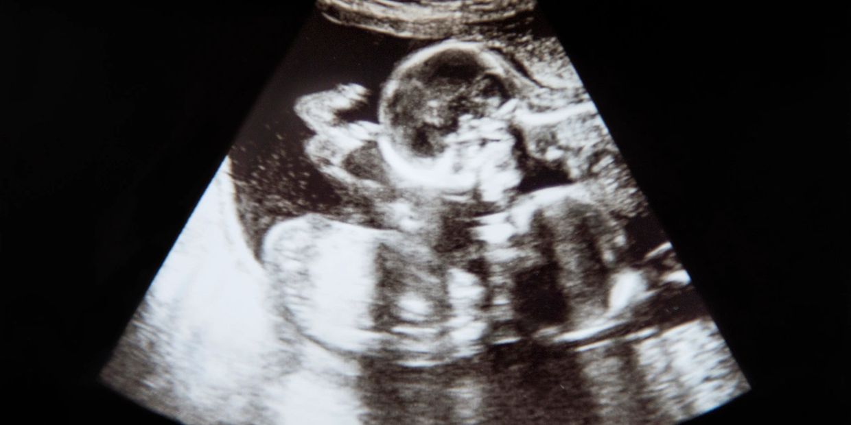 Scan image of baby in the womb