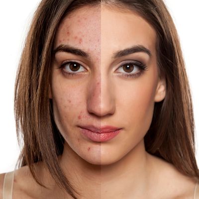 Transform your skin with Corium Corrective 360°
