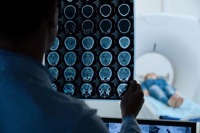 Hemorrhage Brain Injury Lawsuits