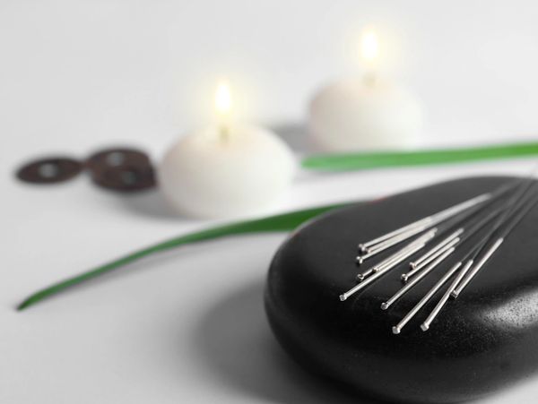 acupuncture for health