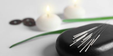 Acupuncture needles